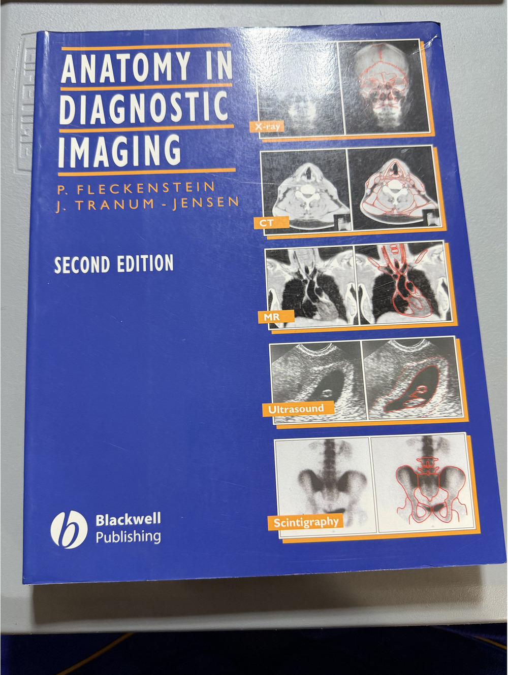 Anatomy in Diagnostic Imaging Peter Fleckenstein J Tranum-Jensen 2nd Ed HC Book
